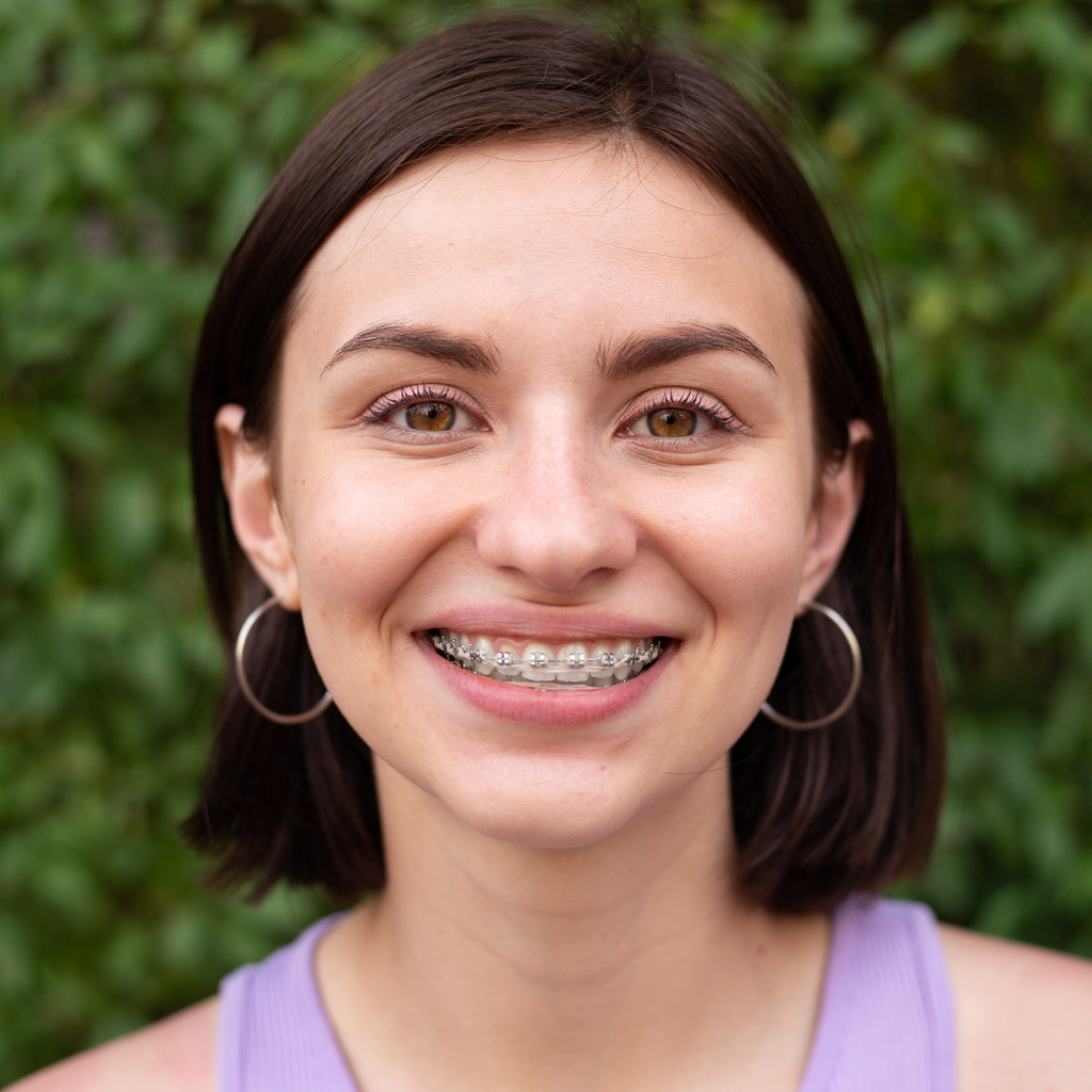 Beyond Aesthetics: The Many Benefits of Aligning Your Teeth with Orthodontic Treatment